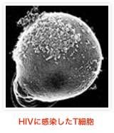 HIV感染したT細胞